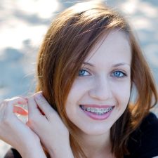 Why Do Braces Hurt at First? Understanding the Adjustment Period